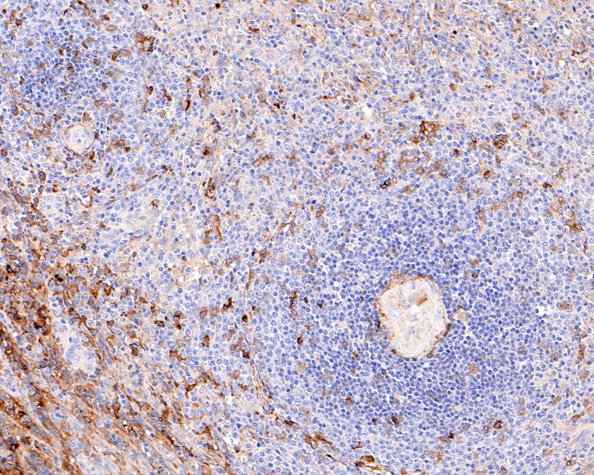 Fig4:; Immunohistochemical analysis of paraffin-embedded human spleen tissue using anti-IgA antibody. The section was pre-treated using heat mediated antigen retrieval with Tris-EDTA buffer (pH 8.0-8.4) for 20 minutes.The tissues were blocked in 5% BSA for 30 minutes at room temperature, washed with ddH; 2; O and PBS, and then probed with the primary antibody ( 1/200) for 30 minutes at room temperature. The detection was performed using an HRP conjugated compact polymer system. DAB was used as the chromogen. Tissues were counterstained with hematoxylin and mounted with DPX.