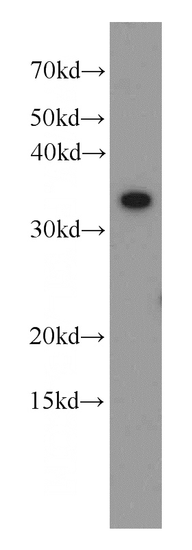 K-562 cells were subjected to SDS PAGE followed by western blot with Catalog No:116455(TXNL1 antibody) at dilution of 1:1000