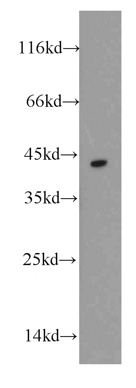 A431 cells were subjected to SDS PAGE followed by western blot with Catalog No:109863(DAPK2-Specific antibody) at dilution of 1:100