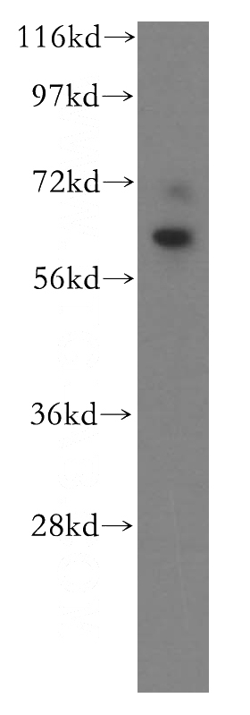 human brain tissue were subjected to SDS PAGE followed by western blot with Catalog No:109880(DBR1 antibody) at dilution of 1:500