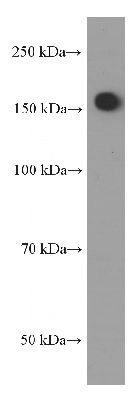 Neuro-2a cells were subjected to SDS PAGE followed by western blot with Catalog No:107329(Nestin Antibody) at dilution of 1:1000