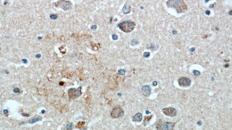 Immunohistochemical of paraffin-embedded human brain using Catalog No:112107(KLHL4 antibody) at dilution of 1:50 (under 40x lens)
