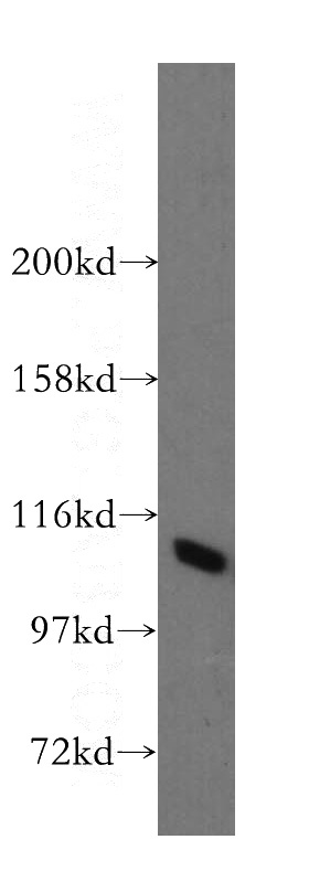 MCF7 cells were subjected to SDS PAGE followed by western blot with Catalog No:115686(STAT2 antibody) at dilution of 1:800