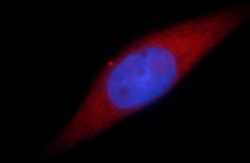 Immunofluorescent analysis of Hela cells, using SMYD2 antibody Catalog No:115407 at 1:25 dilution and Rhodamine-labeled goat anti-rabbit IgG (red). Blue pseudocolor = DAPI (fluorescent DNA dye).