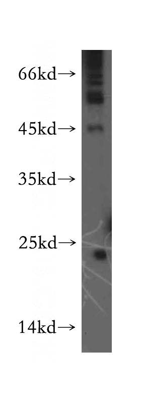 HepG2 cells were subjected to SDS PAGE followed by western blot with Catalog No:114465(RAB9B antibody) at dilution of 1:300