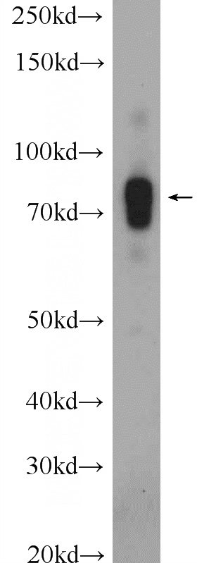 NIH/3T3 cells were subjected to SDS PAGE followed by western blot with Catalog No:107764(ADAM19 Antibody) at dilution of 1:300