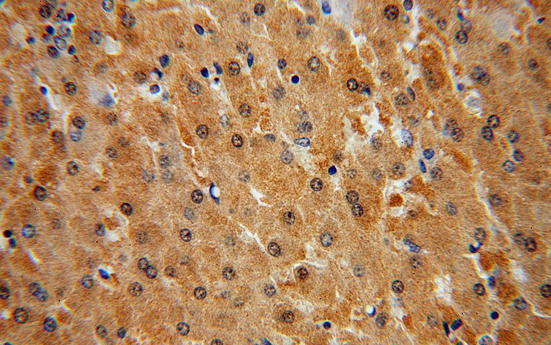 Immunohistochemical of paraffin-embedded human liver using Catalog No:110541(FBXL13 antibody) at dilution of 1:50 (under 40x lens)
