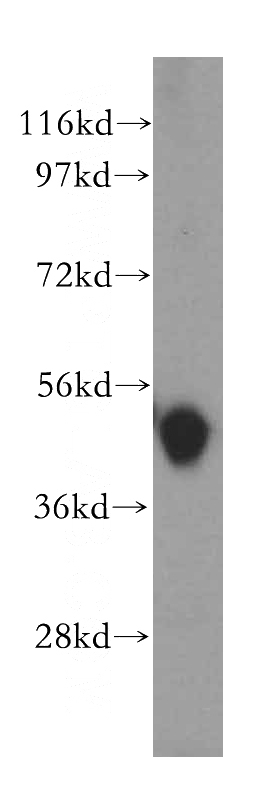 human placenta tissue were subjected to SDS PAGE followed by western blot with Catalog No:116830(WIPI2 antibody) at dilution of 1:200