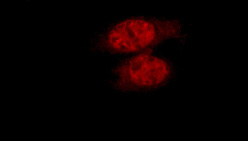 Immunofluorescent analysis of HepG2 cells, using ZNF23 antibody Catalog No:116961 at 1:50 dilution and Rhodamine-labeled goat anti-rabbit IgG (red).