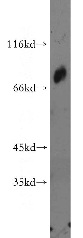 mouse ovary tissue were subjected to SDS PAGE followed by western blot with Catalog No:112588(MED26 antibody) at dilution of 1:500