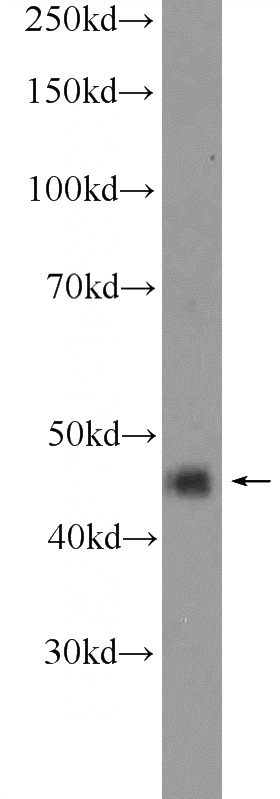 mouse brain tissue were subjected to SDS PAGE followed by western blot with Catalog No:107714(ACTR10 Antibody) at dilution of 1:600