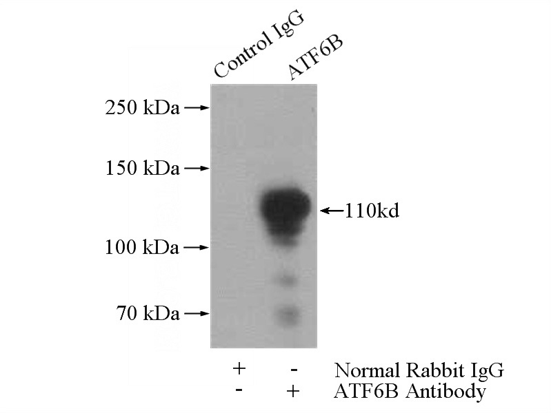 IP Result of anti-ATF6B (IP:Catalog No:108287, 4ug; Detection:Catalog No:108287 1:1000) with Jurkat cells lysate 3200ug.