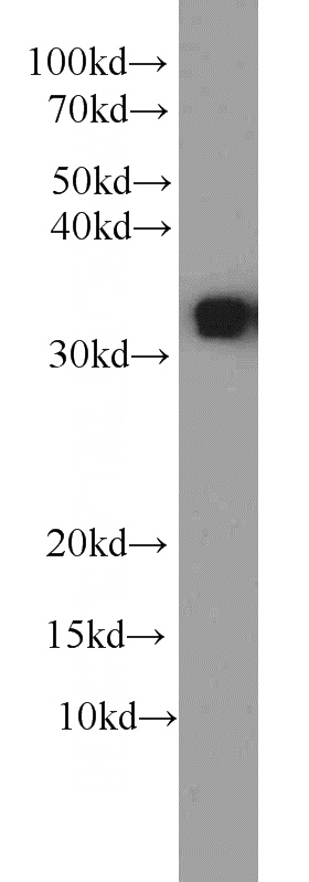 HEK-293 cells were subjected to SDS PAGE followed by western blot with Catalog No:111725(HuR antibody) at dilution of 1:1000