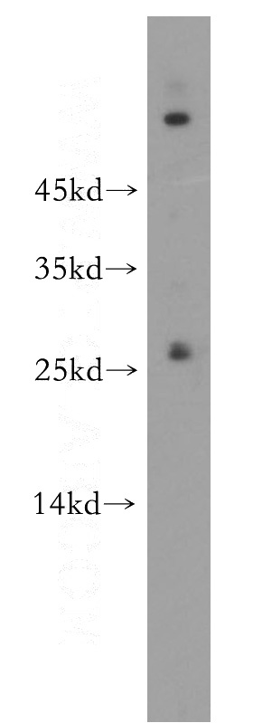 A431 cells were subjected to SDS PAGE followed by western blot with Catalog No:114455(RAB5B antibody) at dilution of 1:300