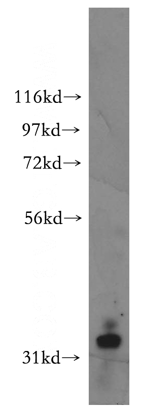 Y79 cells were subjected to SDS PAGE followed by western blot with Catalog No:115145(SFRP2 antibody) at dilution of 1:400