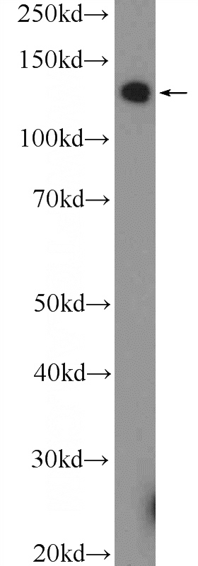 Jurkat cells were subjected to SDS PAGE followed by western blot with Catalog No:113589(PARP10 Antibody) at dilution of 1:600