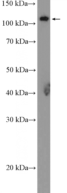 pig lung tissue were subjected to SDS PAGE followed by western blot with Catalog No:110966(GHR Antibody) at dilution of 1:300