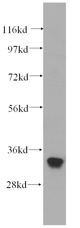 HeLa cells were subjected to SDS PAGE followed by western blot with Catalog No:110509(EXOSC2 antibody) at dilution of 1:500