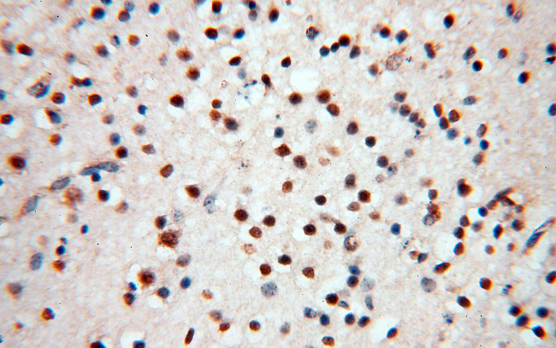 Immunohistochemical of paraffin-embedded human brain using Catalog No:112634(MEF2C antibody) at dilution of 1:50 (under 40x lens)