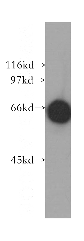 HeLa cells were subjected to SDS PAGE followed by western blot with Catalog No:112751(MPP7 antibody) at dilution of 1:500