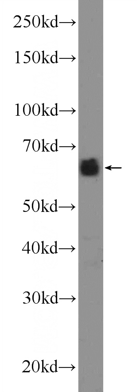 mouse brain tissue were subjected to SDS PAGE followed by western blot with Catalog No:108985(CCDC67 Antibody) at dilution of 1:600