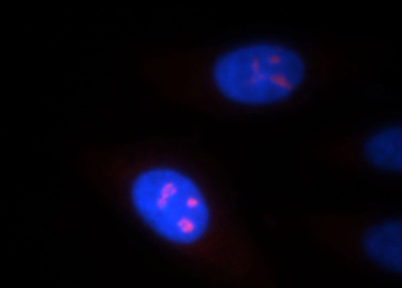 Immunofluorescent analysis of HepG2 cells, using NOL8 antibody Catalog No:113297 at 1:25 dilution and Rhodamine-labeled goat anti-rabbit IgG (red). Blue pseudocolor = DAPI (fluorescent DNA dye).
