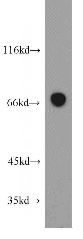 human skeletal muscle tissue were subjected to SDS PAGE followed by western blot with Catalog No:115214(SESN1 antibody) at dilution of 1:500