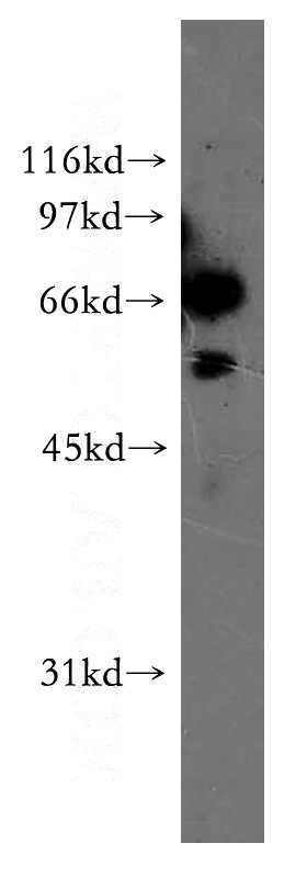 A2780 cells were subjected to SDS PAGE followed by western blot with Catalog No:110276(ELF2 antibody) at dilution of 1:500