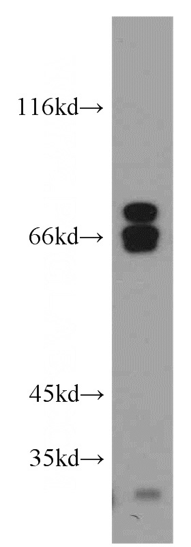 HeLa cells were subjected to SDS PAGE followed by western blot with Catalog No:113136(NF2 antibody) at dilution of 1:1000