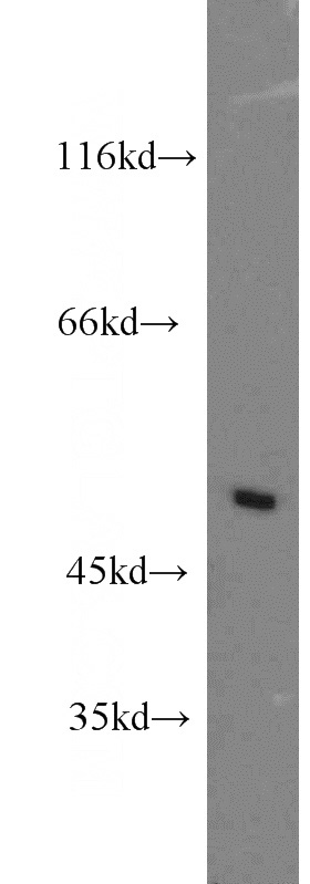 SH-SY5Y cells were subjected to SDS PAGE followed by western blot with Catalog No:116941(ZMYND10 antibody) at dilution of 1:400
