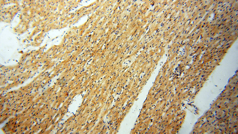 Immunohistochemical of paraffin-embedded human heart using Catalog No:116680(USP38 antibody) at dilution of 1:50 (under 10x lens)