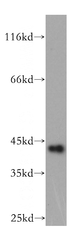 Y79 cells were subjected to SDS PAGE followed by western blot with Catalog No:110920(GDAP1L1 antibody) at dilution of 1:400