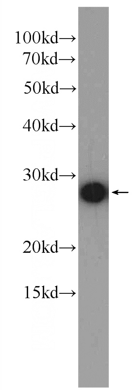 MCF-7 cells were subjected to SDS PAGE followed by western blot with Catalog No:108867(CSNK2B Antibody) at dilution of 1:1000