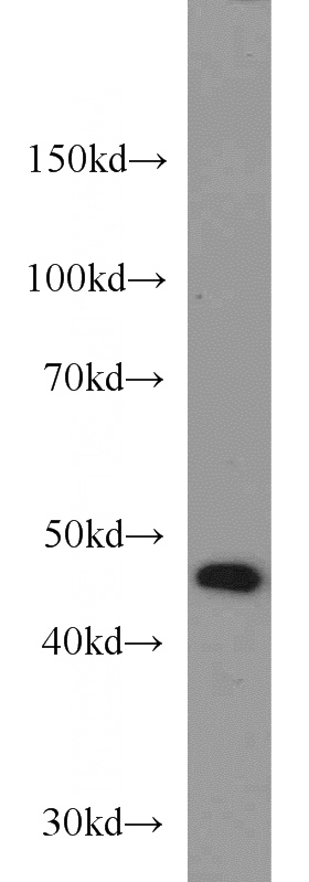 COLO 320 cells were subjected to SDS PAGE followed by western blot with Catalog No:115877(TBL2 antibody) at dilution of 1:500