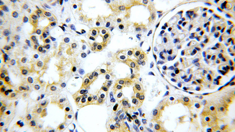 Immunohistochemical of paraffin-embedded human kidney using Catalog No:117259(ZO1 antibody) at dilution of 1:100 (under 40x lens)