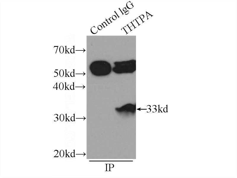 IP Result of anti-THTPA (IP:Catalog No:116058, 3ug; Detection:Catalog No:116058 1:800) with K-562 cells lysate 1720ug.