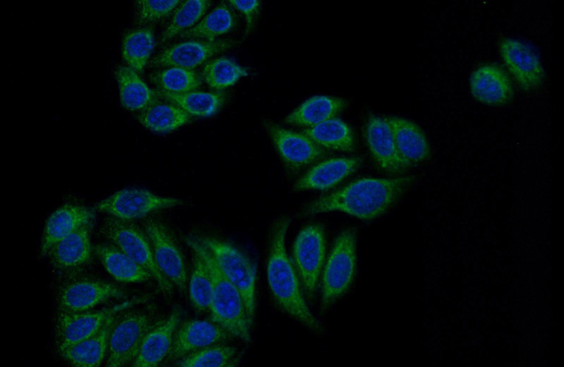 Immunofluorescent analysis of HeLa cells using Catalog No:108303(ATP6V0D1 Antibody) at dilution of 1:50 and Alexa Fluor 488-congugated AffiniPure Goat Anti-Rabbit IgG(H+L)