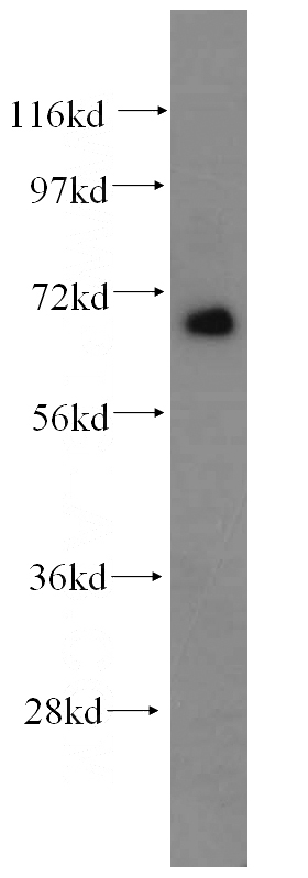 K-562 cells were subjected to SDS PAGE followed by western blot with Catalog No:116008(TFE3 antibody) at dilution of 1:500