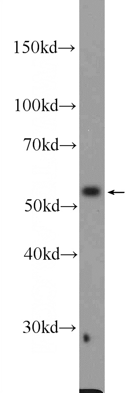 HepG2 cells were subjected to SDS PAGE followed by western blot with Catalog No:109981(DKC1 Antibody) at dilution of 1:600