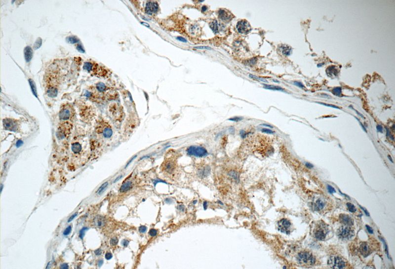 Immunohistochemistry of paraffin-embedded human testis tissue slide using Catalog No:111017(GKAP1 Antibody) at dilution of 1:50 (under 40x lens)