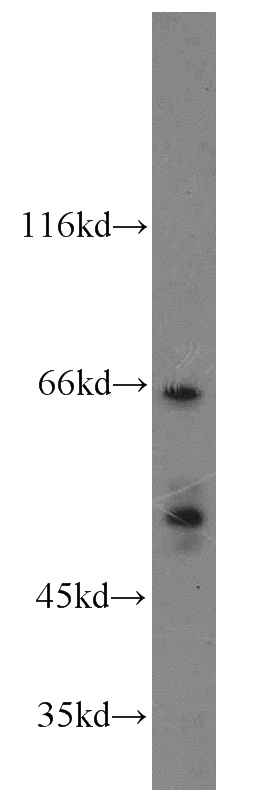 K-562 cells were subjected to SDS PAGE followed by western blot with Catalog No:112903(MUTYH antibody) at dilution of 1:300