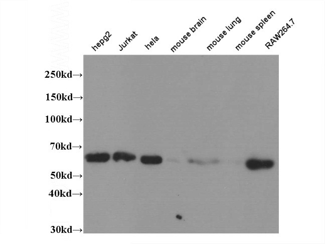 WB result of Catalog No:(ABCG1 antibody) on multiple lysates.
