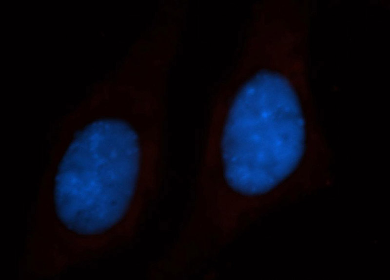 Immunofluorescent analysis of HepG2 cells, using Catalog No:113341 and Rhodamine-labeled goat anti-rabbit IgG (red). Blue pseudocolor = DAPI (fluorescent DNA dye).