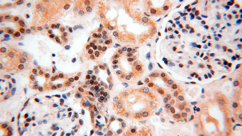Immunohistochemical of paraffin-embedded human kidney using Catalog No:112603(MGMT antibody) at dilution of 1:100 (under 40x lens)