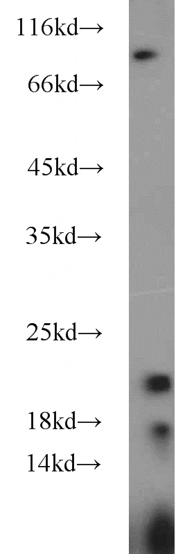 HEK-293 cells were subjected to SDS PAGE followed by western blot with Catalog No:109713(CYPC antibody) at dilution of 1:1000
