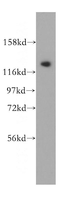 Jurkat cells were subjected to SDS PAGE followed by western blot with Catalog No:109113(CDCA2 antibody) at dilution of 1:500