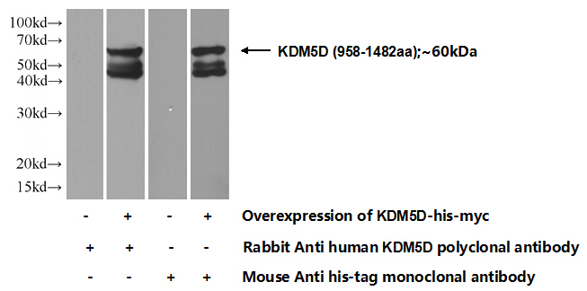 Transfected HEK-293 cells were subjected to SDS PAGE followed by western blot with Catalog No:112030(KDM5D Antibody) at dilution of 1:700