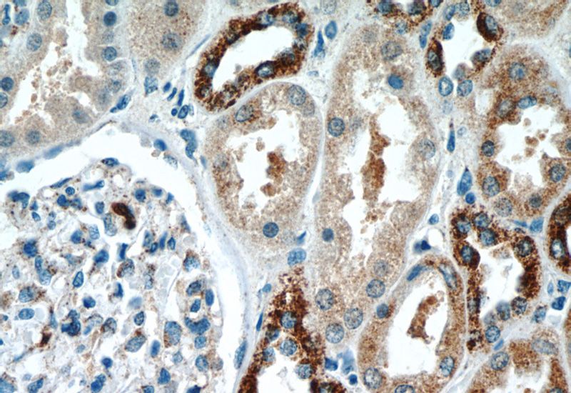 Immunohistochemistry of paraffin-embedded human kidney tissue slide using Catalog No:111999(KIF12 Antibody) at dilution of 1:50 (under 40x lens)