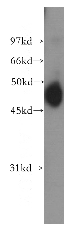 A431 cells were subjected to SDS PAGE followed by western blot with Catalog No:109079(CCRL2 antibody) at dilution of 1:400