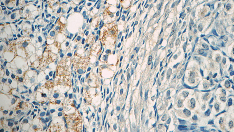 Immunohistochemistry of paraffin-embedded human ovary tissue slide using Catalog No:117038(ZER1 Antibody) at dilution of 1:50 (under 40x lens)